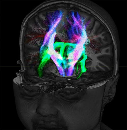 UVM research fiber tracking density