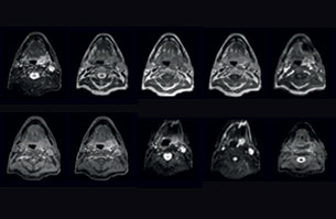 mri of head clinical case